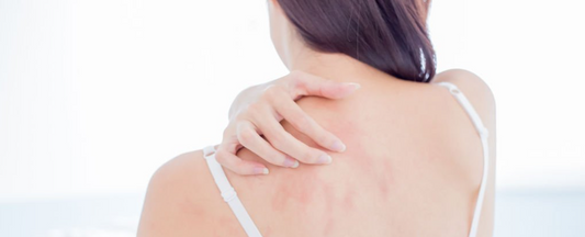 Cremas para piel sensible: soluciones efectivas para el picor y la irritación